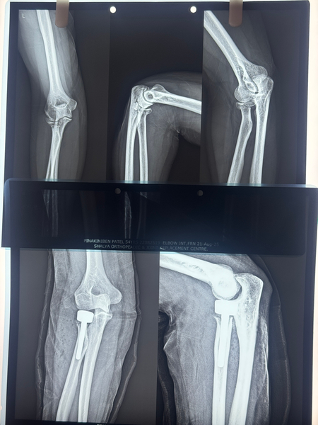 Cover photo of Vedant Physiotherapy & Rehabilitation Center in Ghatlodiya, Satadhar, Ahmedabad